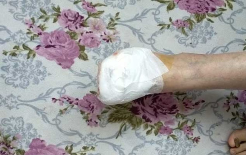 Samsun'da başıboş pitbull çocuklara saldırdı!