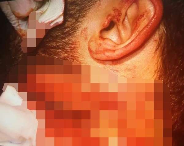 İzmir'de doktora jiletli saldırıyı yapan zanlı: 'Dövmeye gittim' 