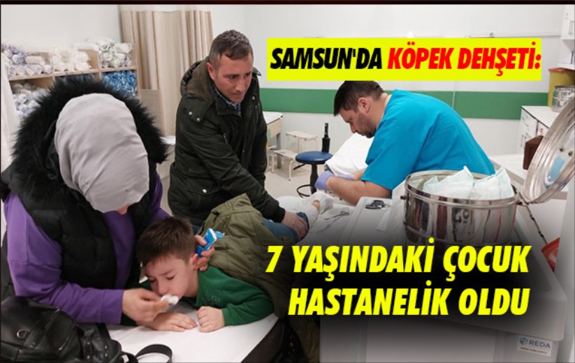 Samsun'da köpek dehşeti: 7 yaşındaki çocuk hastanelik oldu