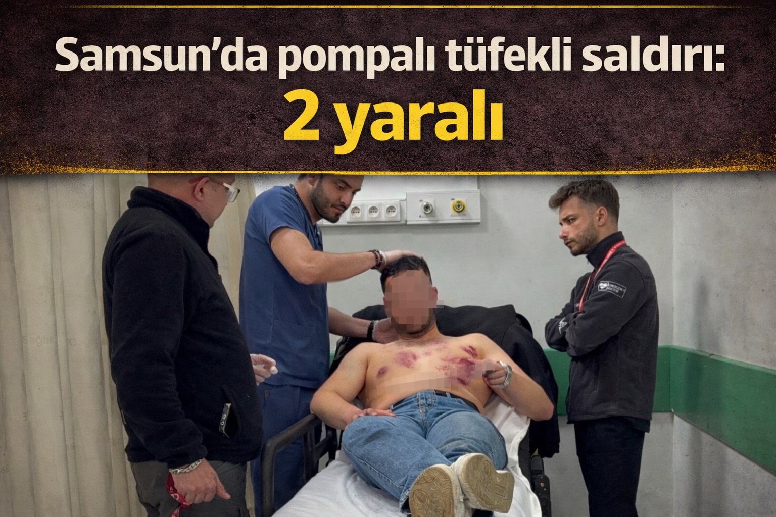 Samsun'da pompalı tüfekli saldırı: 2 yaralı
