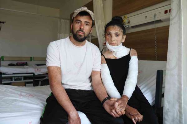 Azerbaycanlı çiftin doğal gaz patlamasında kapanan elleri, 3 yıl sonunda Eskişehir'deki tedaviyle kavuştu