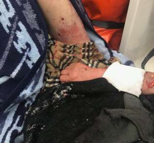 Kayseri'den sonra Kırşehir'de köpek saldırısı
