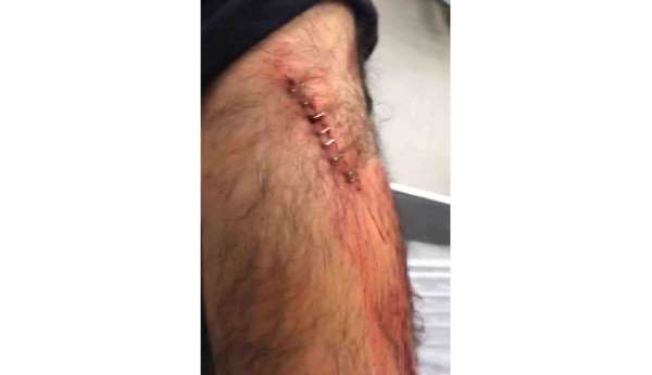 Şanlıurfa'da görev yapan öğretmene sokak ortasında jiletli saldırı