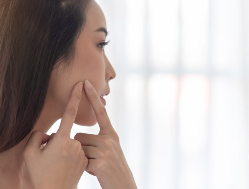 Rüyada Sivilce Sıkmak Ne Anlama Gelir?