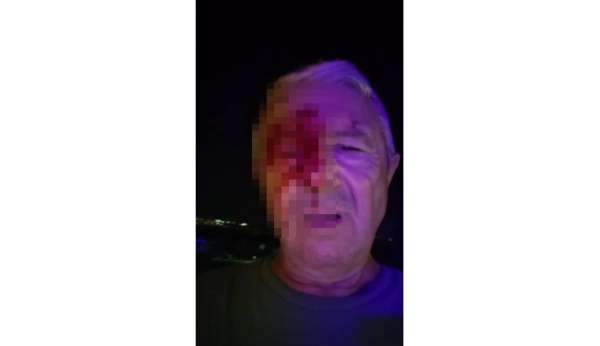 Haber yaparken saldırıya uğrayan muhabir yaralandı