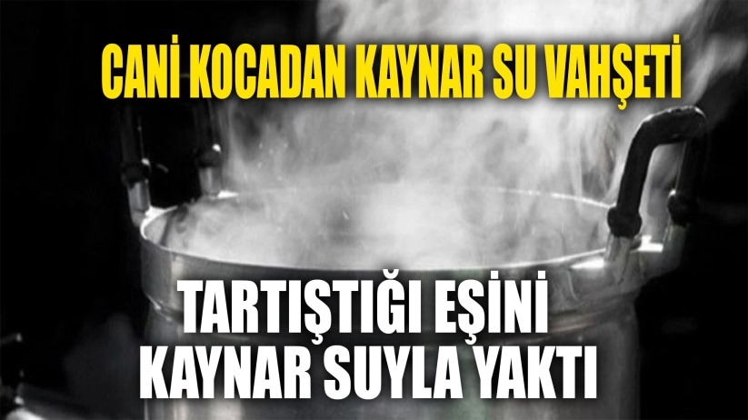  CANİ KOCA TARTIŞTIĞI EŞİNİ KAYNAR SUYLA YAKTI