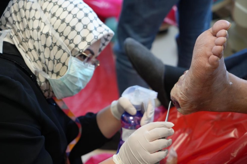 Samsun'da sinek larvaları ile yara tedavisi: Çürümüş dokuları yiyorlar, bölge kesilmekten kurtuluyor