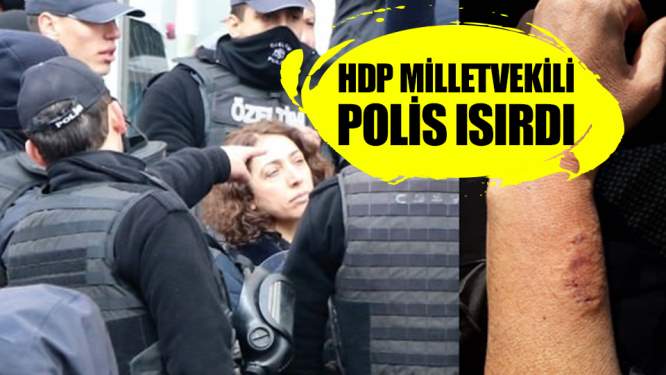HDP'li milletvekili, polisin kolunu ısırdı