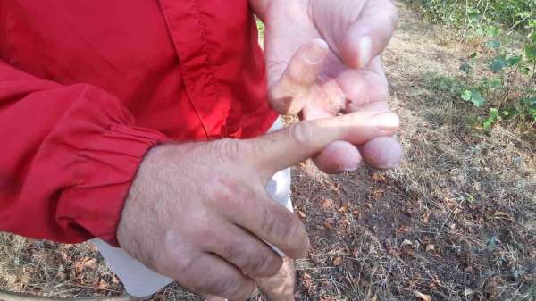 Ayının saldırısına uğrayan çiftçi dehşet anlarını anlattı: 'Parmağımı kopardı'