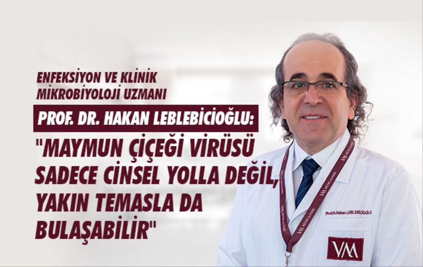 'Maymun çiçeği virüsü sadece cinsel yolla değil, yakın temasla da bulaşabilir'