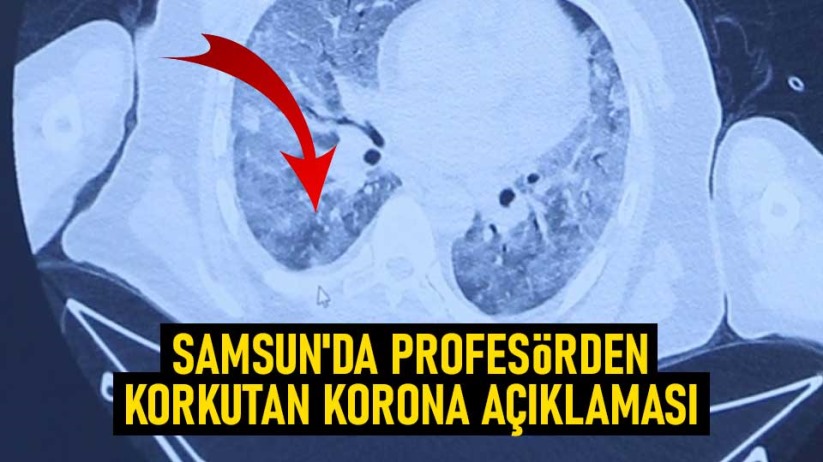 Samsun'da Profesörden korkutan korona açıklaması
