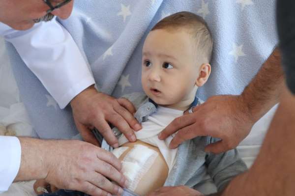 Tıpta nadir rastlanan durum: 1 yaşındaki bebeğin safra kesesinden 5 taş çıkarıld