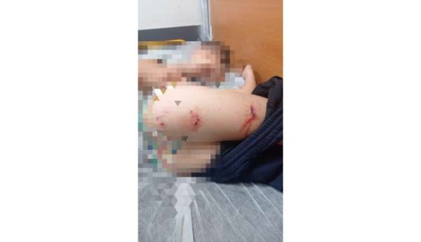 Sokak köpekleri faciaya neden oluyordu: Komşular yetişmeseydi parçalayacaklardı