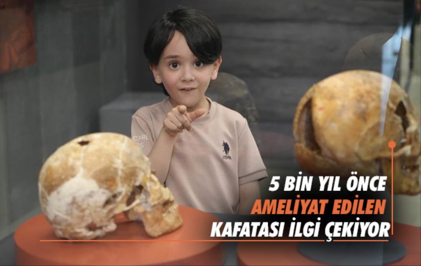 Samsun'da 5 bin yıl önce ameliyat edilen kafatası ilgi çekiyor