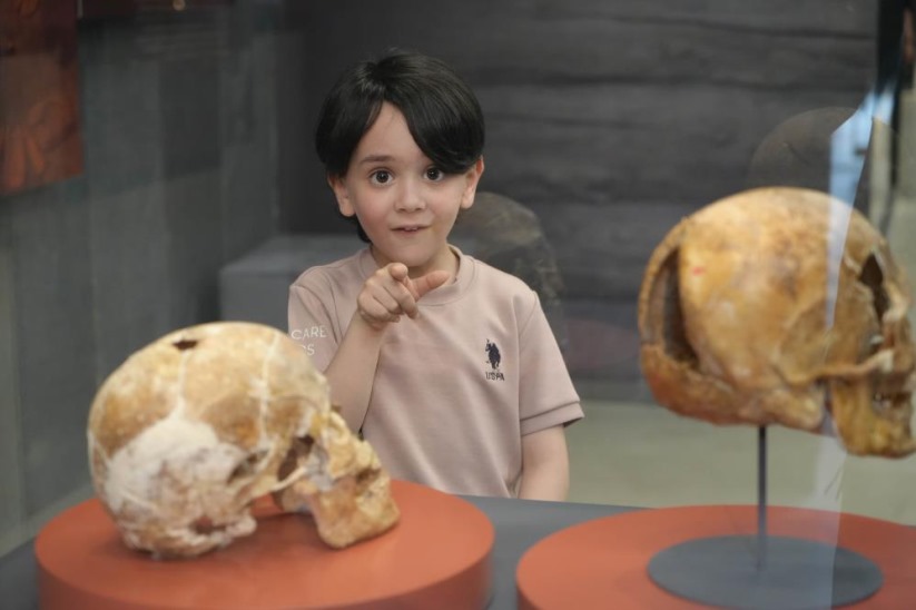 Samsun'da 5 bin yıl önce ameliyat edilen kafatası ilgi çekiyor