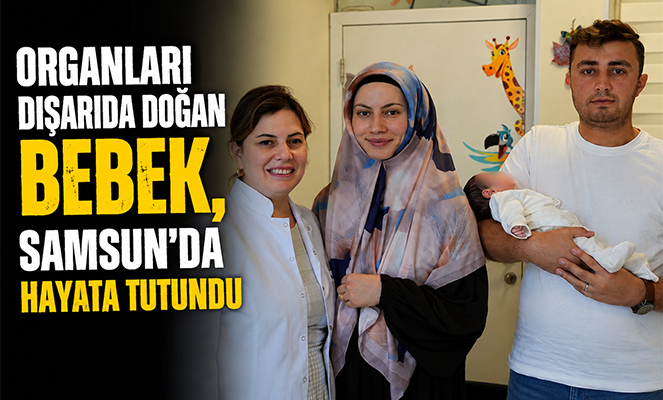 Organları dışarıda doğan bebek, Samsun'da hayata tutundu
