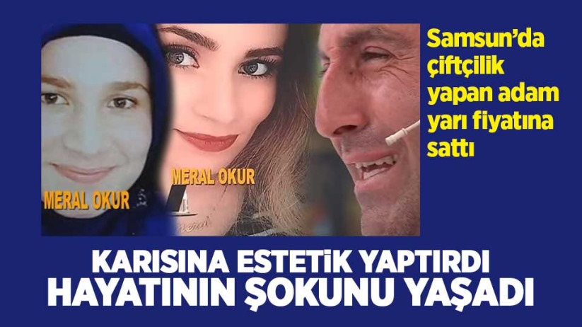 Samsun'da çiftçilik yapan koca karısına estetik yaptırdı ve...