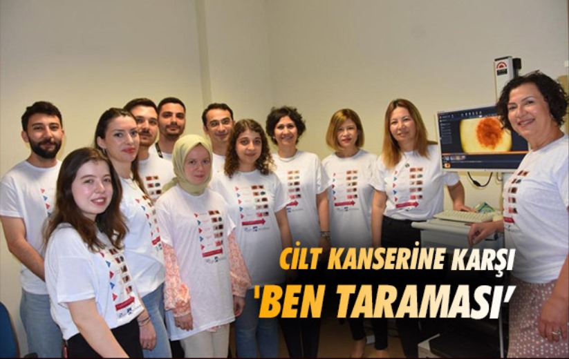 Samsun'da cilt kanserine karşı 'ben taraması'