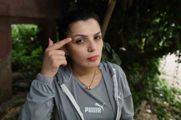 Cezaevinden firar etti, yüzünü bıçakladığı kadına 'Affına sığınıyorum' mesajı attı