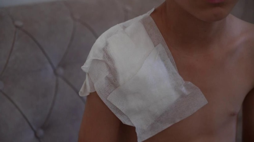 Samsun'da köpek saldırısında Yunus'un kolu kullanılamaz hale geldi, aile adalet arıyor