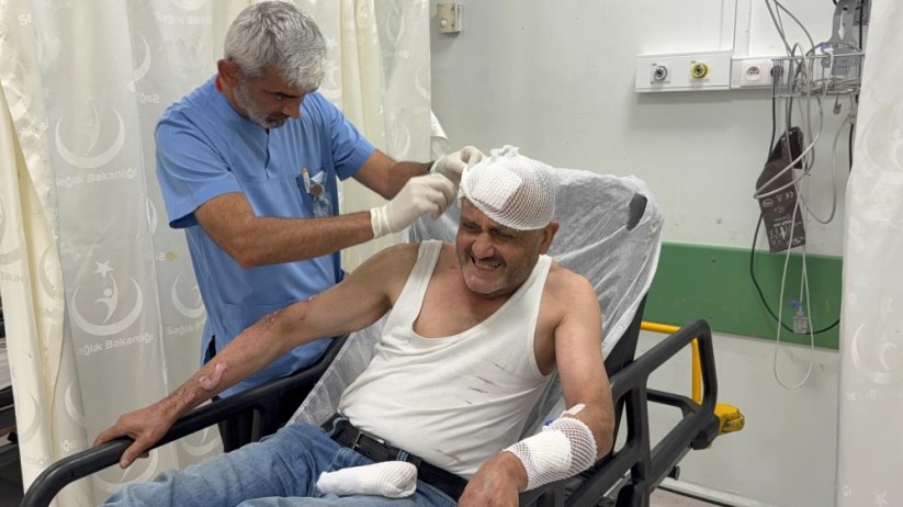 Samsun'da tüp parlamasıyla alevler içinde kalan şahıs dereye atlayarak yanmaktan kurtuldu