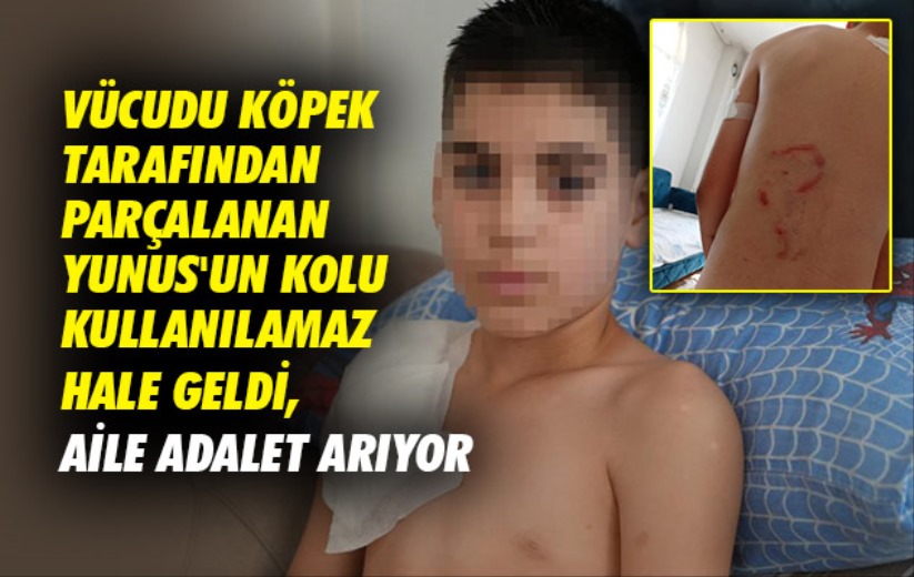 Samsun'da köpek saldırısında Yunus'un kolu kullanılamaz hale geldi, aile adalet arıyor