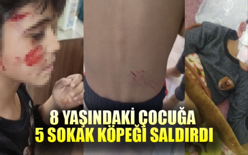 Gaziantep'te 8 yaşındaki çocuğa 5 sokak köpeği saldırdı