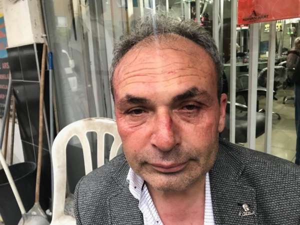 CHP'li Belediye Başkan Yardımcısına saldırı anı güvenlik kamerasında 