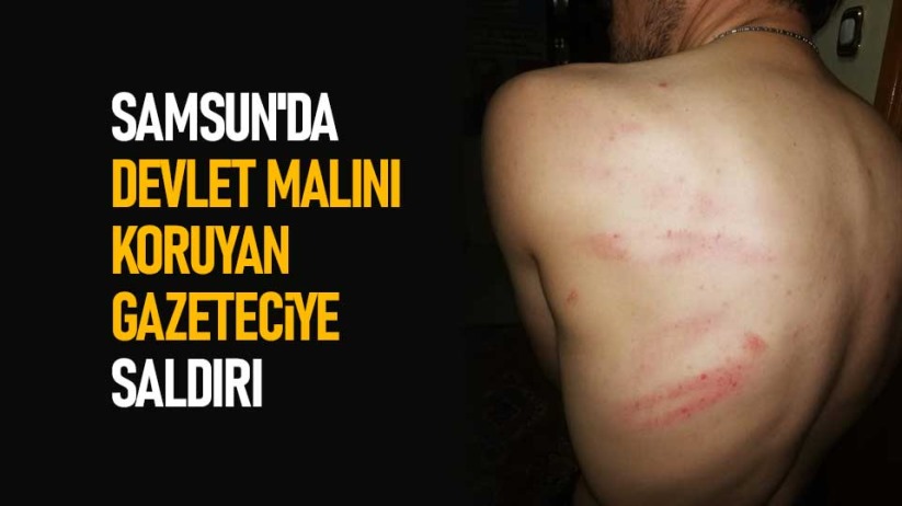 Samsun'da devlet malını koruyan gazeteciye saldırı
