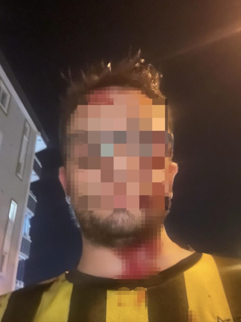 Samsun'da daire satışı nedeniyle çıkan tekme ve sopalı kavga güvenlik kamerasında