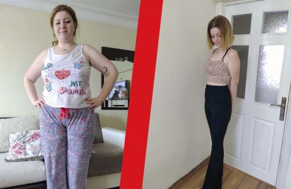 Tüp mide ameliyatı oldu arkadaşları bile tanıyamadı 