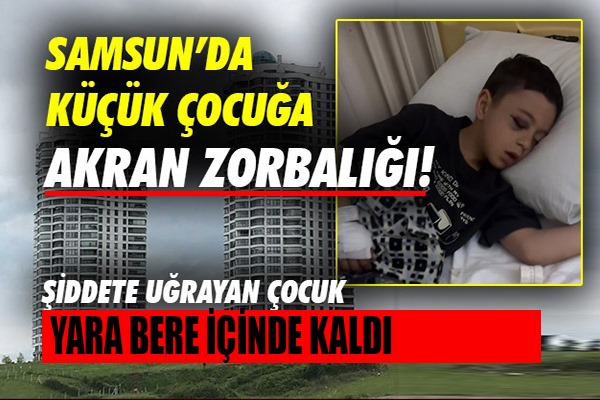 Samsun'da küçük çocuğa akran zorbalığı!