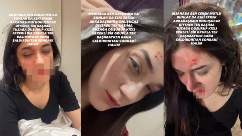 Samsun'da Eski Erkek Arkadaşından 'Öldüresiye Darp' İddiası 