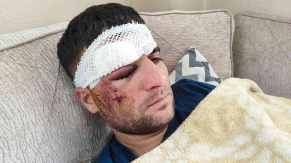 Döner ustası motosiklet sürücüsü: 'Kaza sonrası kaçıp gittiler'