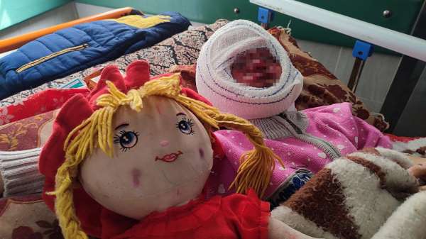 İsrail'in saldırılarında yüzü yanan 4 yaşındaki Seca, tedavi için bekliyor