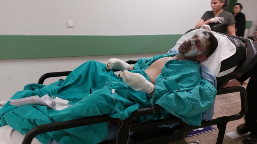 Samsun'da yaktığı ateşe tiner döken genç ağır yaralandı