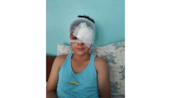 Şanlıurfa'da köpek saldırısından kaçan çocuğa otomobil çarptı