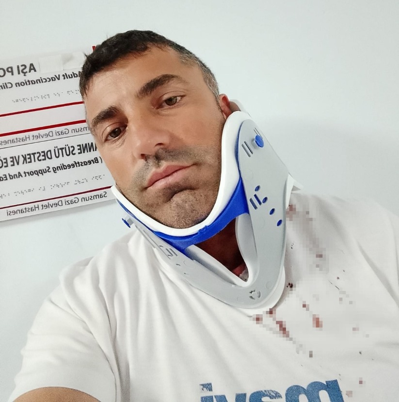 İnşaat işçisi baba evinin önünde beyzbol sopalarıyla dövüldü Samsun'u terk etti
