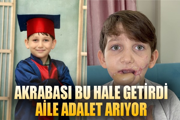 10 yaşındaki çocuk tüfekle çenesinden vuruldu, aile 'adalet' arıyor