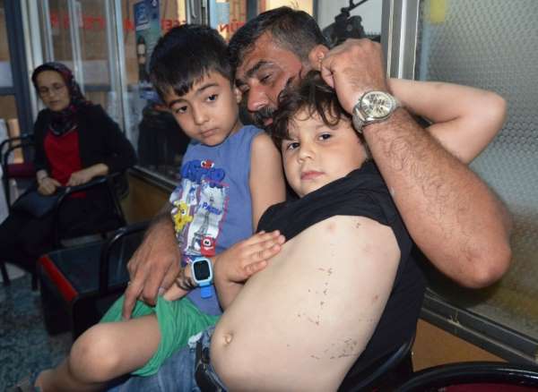 Sokak köpekleri 2 küçük çocuğa saldırarak yaraladı 