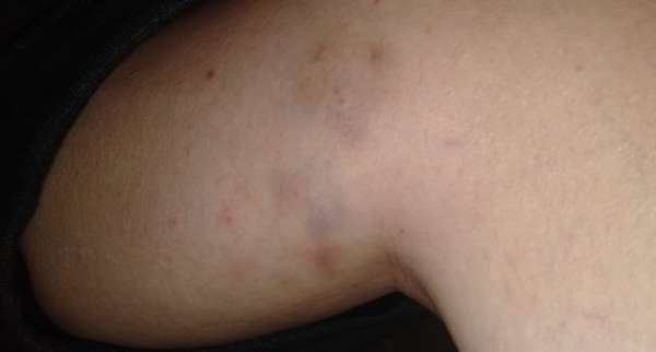 Bursa'da tecavüz iddiasına sosyal medyada tepki yağdı 