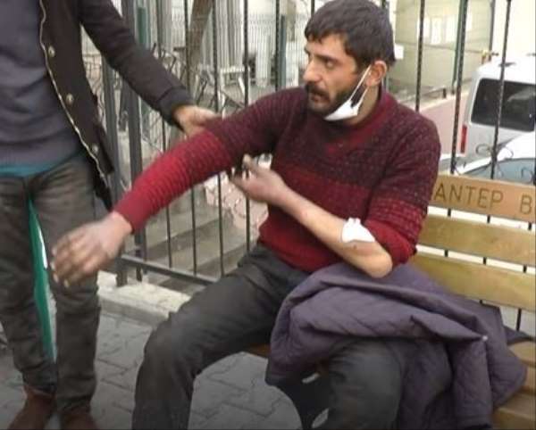 Gaziantep'teki ikinci pitbull saldırısında 2 şahıs gözaltına alındı - Gaziantep haber