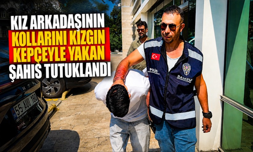 Kız arkadaşının kollarını kızgın kepçeyle yakan şahıs tutuklandı