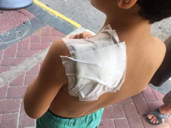 Antalya'da ilkokul öğrencisi, okul dönüşü sokak kopeğinin saldırısına uğradı