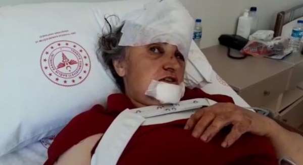 Trabzon'da 5 kişinin öldüğü, 36 kişinin de yaralandığı belediye otobüsü kazasında yaralanan yolcular kazanın ş
