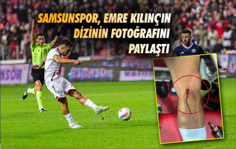 Samsunspor, Emre Kılınç'ın dizinin fotoğrafını paylaştı