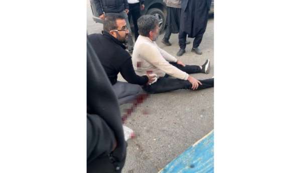 Şanlıurfa'da bıçaklı kavga: 1 yaralı