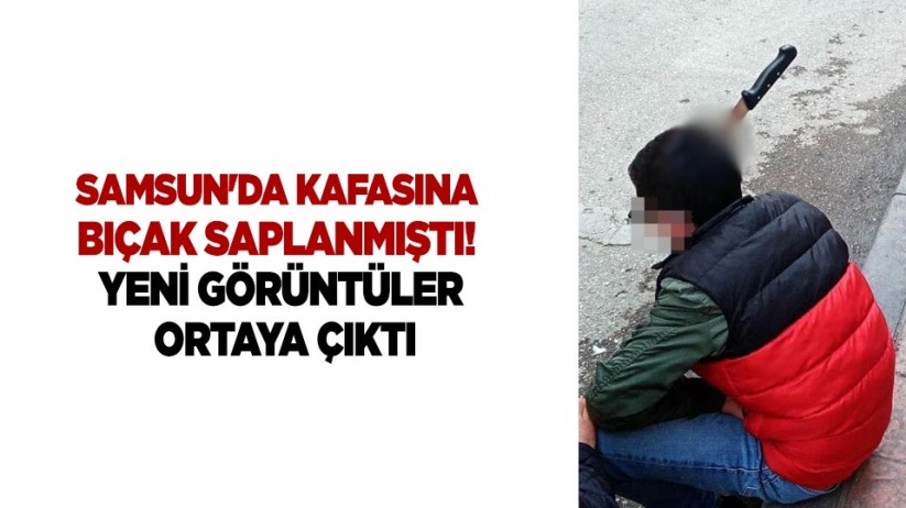 Samsun'da kafasına bıçak saplanmıştı! Yeni görüntüler ortaya çıktı