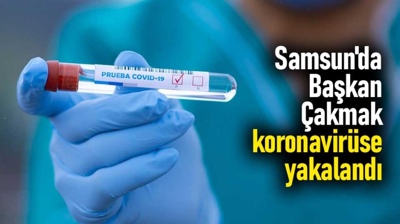 Samsun'da Başkan Çakmak, koronavirüse yakalandı
