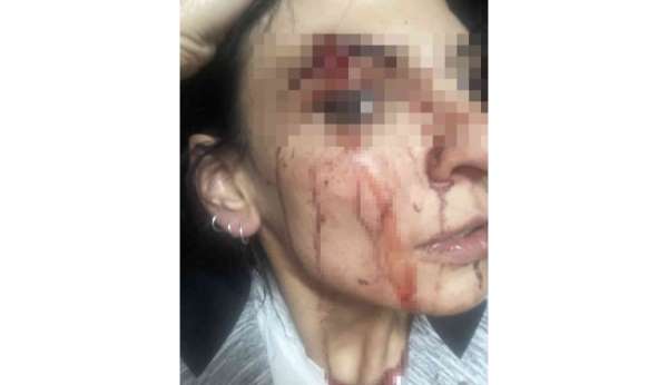 Esenyurt'ta site içerisinde alkol aldığı iddia edilen kadınları tekme tokat dövdüler - İstanbul haber